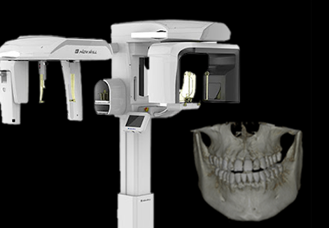 컴퓨터 분석 임플란트(3D-CT)