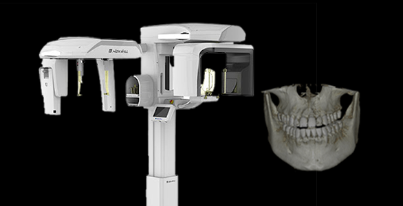 3D-CT 기기 및 촬영 화면