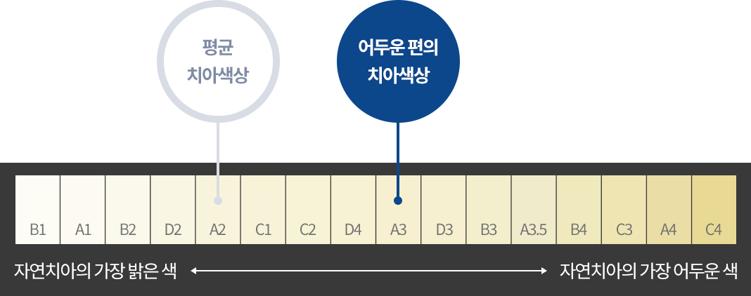 치아색상