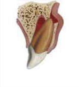 Lateral Luxation