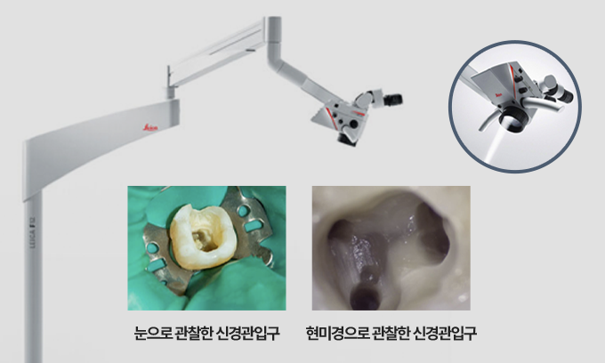 최신 Leica 치과용 미세현미경