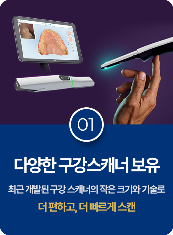 다양한 구강스캐너 보유