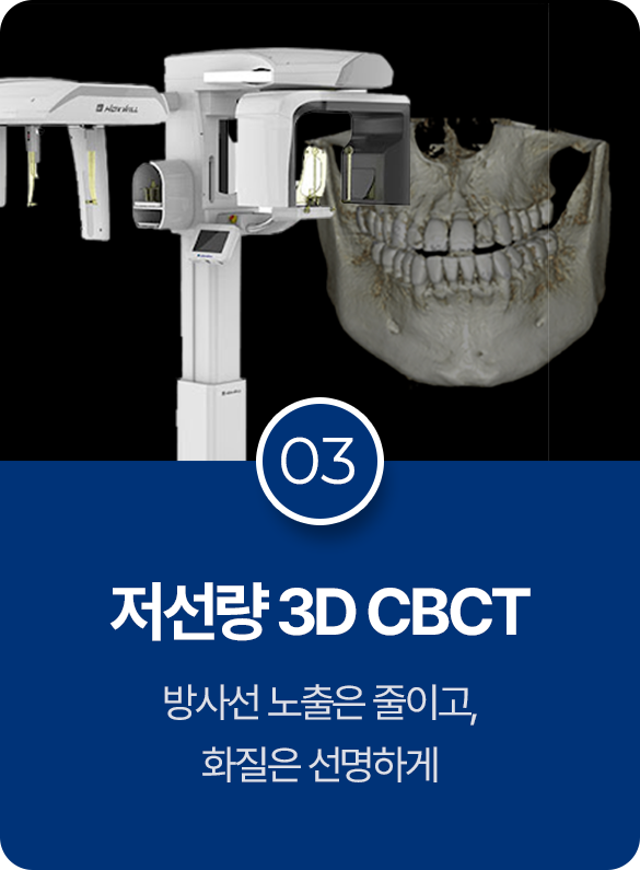 저선량 3D CBCT